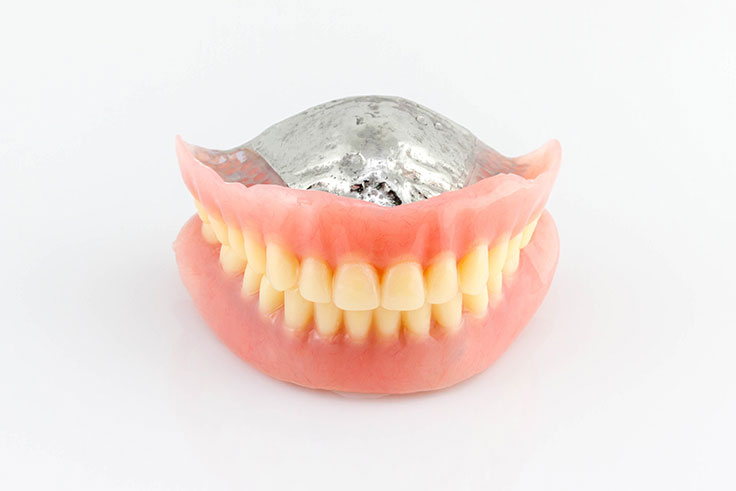 部分入れ歯（部分義歯）