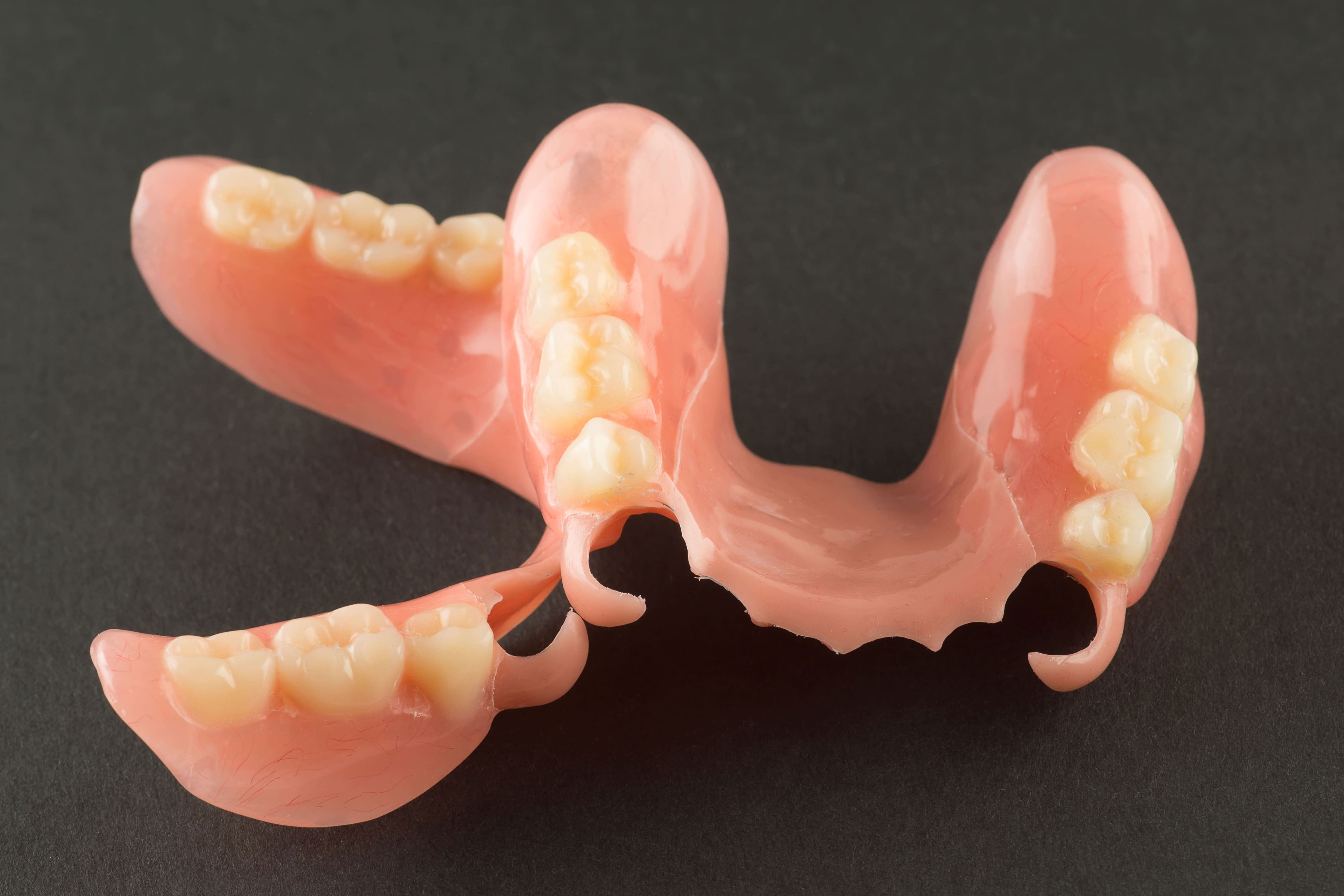 部分入れ歯（部分義歯）