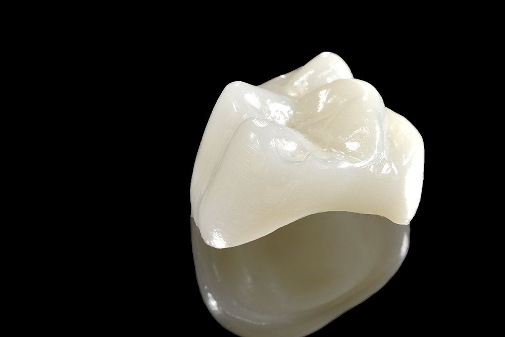 セラミック治療（詰め物・被せ物）