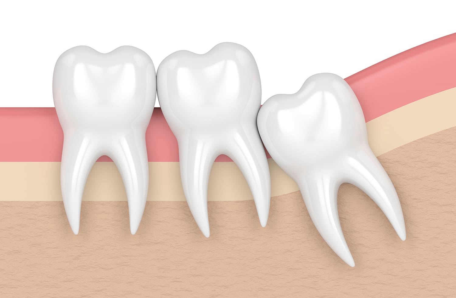 親知らずについて